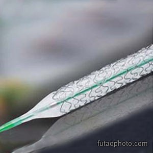 生物降解镁合金支架